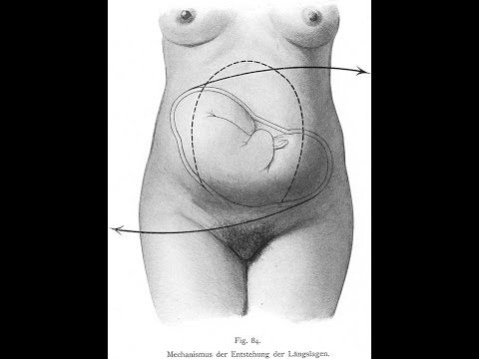 fetal position of baby during pregnancy workouts.jpg